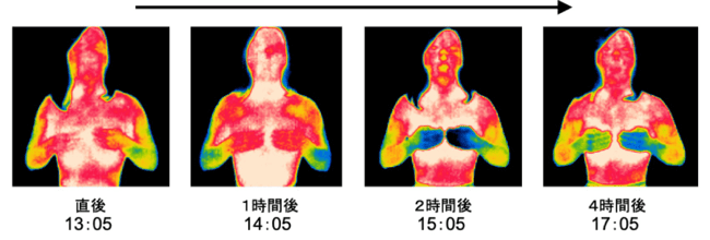 サーモグラフィーで計ったインディバ施術後の全身の体温変化を表した写真